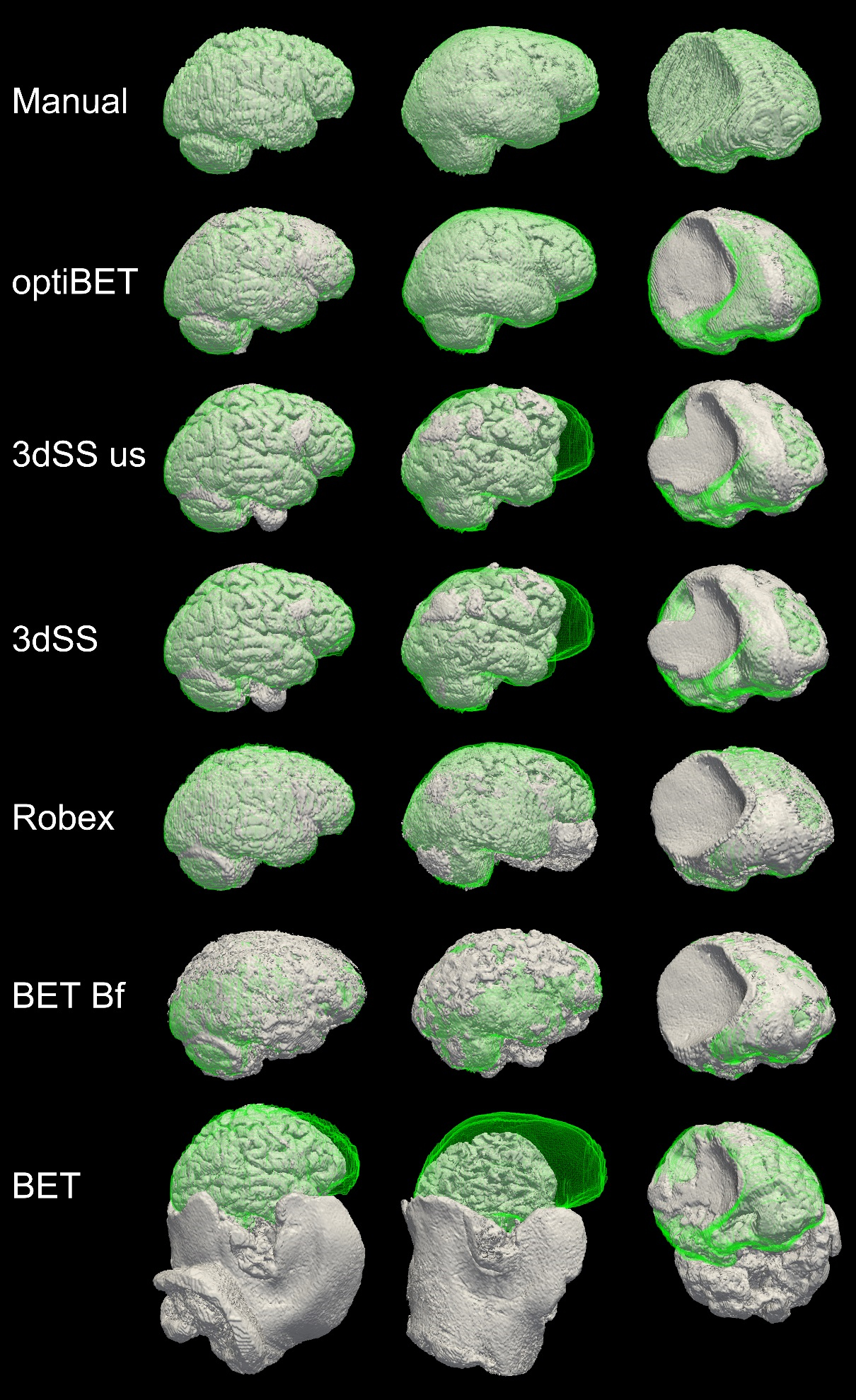 Rendering of brain extractions obtained from different algorithms with overlaid benchmark.