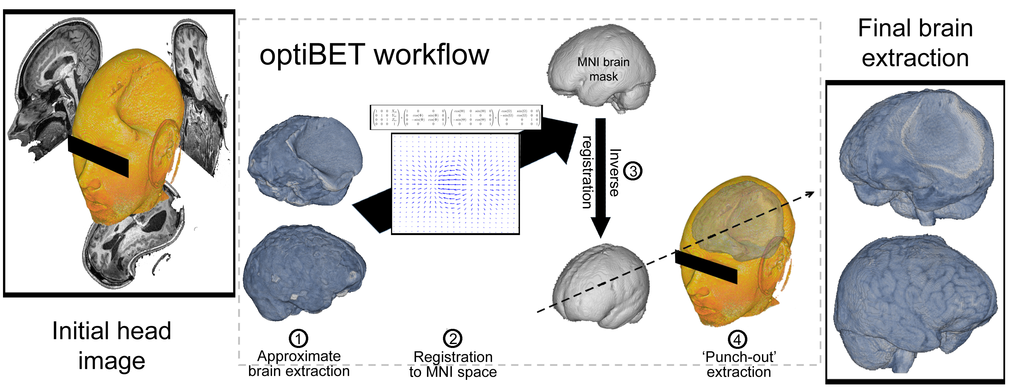 Visual representation of the optiBET script workflow: (1) initial approximate brain extraction is performed using BET (and options ‘B’ and ‘f’, as suggested previously [5]); (2) sequential application of a linear and non-linear transformation from native space to MNI template space; (3) back-projection of a standard brain-only mask from MNI to native space; and (4) mask-out brain extraction.
